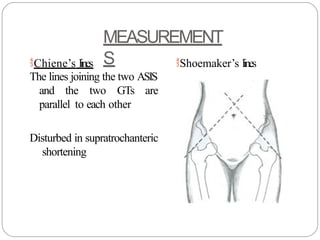 Comprehensive Clinical Hip examination ppt | PPTX