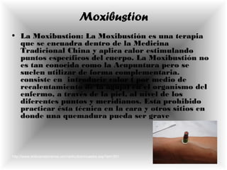 Moxibustion
• La Moxibustion: La Moxibustión es una terapia
que se encuadra dentro de la Medicina
Tradicional China y aplica calor estimulando
puntos específicos del cuerpo. La Moxibustión no
es tan conocida como la Acupuntura pero se
suelen utilizar de forma complementaria.
consiste en introducir calor ( por medio de
recalentamiento de la aguja) en el organismo del
enfermo, a través de la piel, al nivel de los
diferentes puntos y meridianos. Esta prohibido
practicar ésta técnica en la cara y otros sitios en
donde una quemadura pueda ser grave
http://www.enbuenasmanos.com/articulos/muestra.asp?art=391
 