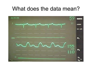 What does the data mean?
 