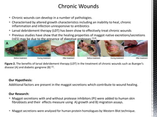  Chronic wounds can develop in a number of pathologies.
 Characterised by altered growth characteristics including an inability to heal, chronic
inflammation and infection unresponsive to antibiotics
 Larval debridement therapy (LDT) has been show to effectively treat chronic wounds
 Previous studies have show that the healing properties of maggot native excretions/secretions
(nES) may be due to the presence of digestive proteases [3,4].
Our Hypothesis:
Additional factors are present in the maggot secretions which contribute to wound healing.
Our Research:
 Maggot secretions with and without protease inhibitors (PI) were added to human skin
fibroblasts and their effects measure using A) growth and B) migration assays.
 Maggot secretions were analysed for human protein homologues by Western Blot technique.
A B
Figure 2. The benefits of larval debridement therapy (LDT) in the treatment of chronic wounds such as Buerger's
disease (A) and diabetic gangrene (B) [2].
 