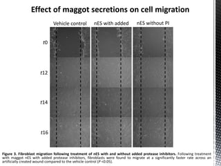 Vehicle control nES with added
PI
nES without PI
t0
t12
t14
t16
Figure 3. Fibroblast migration following treatment of nES with and without added protease inhibitors. Following treatment
with maggot nES with added protease inhibitors, fibroblasts were found to migrate at a significantly faster rate across an
artificially created wound compared to the vehicle control (P <0.05).
 
