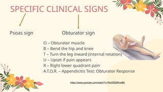 Testing Obturator Sign Acute Appendicitis for Diploma in Nursing students | PPTX
