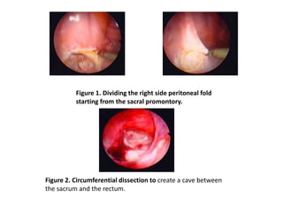 Journal club presentation | PPTX