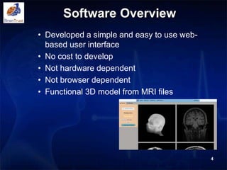 Software Overview
• Developed a simple and easy to use web-
based user interface
• No cost to develop
• Not hardware dependent
• Not browser dependent
• Functional 3D model from MRI files
4
 