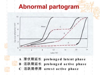 A  潜伏期延长  prolonged latent phase B  活跃期延长  prolonged active phase C  活跃期停滞  arrest active phase Abnormal partogram 