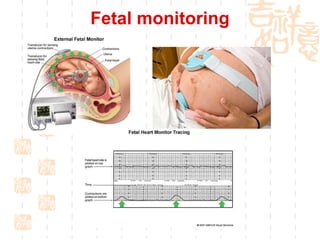 Fetal monitoring 