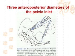 Three anteroposterior diameters of   the pelvic inlet 