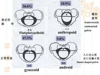 正常骨盆 入口呈心型 出口呈漏斗型 funnel shaped pelvis 47.3% 5.8% 36.6% 10.9% gynecoid android Flat(platypelloid) anthropoid 前后径 狭  窄 横径 狭窄 transversely contracted  pelvis 女性 男性 