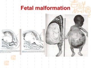 Fetal malformation 