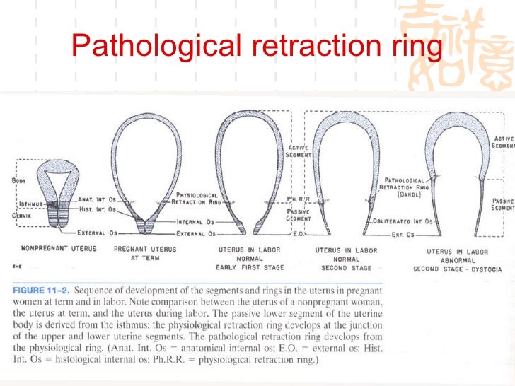 6 abnormal labor and dystocia