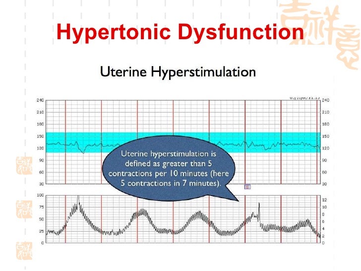 Abnormal Dysfunction - Non-Functional Disorder plus Sequence E.P. Abnormal Dysfunction - Non-Functional Disorder plus Sequence E.P.