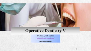 ALPINE SKI HOUSE
Dr. Inas Ayoub Elalem
inas.alalem@gmail.com
00970599448344
1
Operative Dentistry V
 