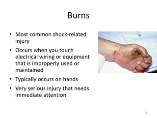 50
Burns
• Most common shock-related
injury
• Occurs when you touch
electrical wiring or equipment
that is improperly used or
maintained
• Typically occurs on hands
• Very serious injury that needs
immediate attention
 