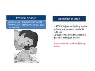 Provjeri disanje
Gledaj, slušaj i osjećaj je li žrtva diše
NORMALNO i istovremeno pipaj puls
- 10 sekundi
Agonalno disanje
U 40% slučajeva kardijalnog aresta
javlja se kratko nakon prestanka
rada srca
Opisuje se kao oskudno, naporno,
glasno ili dahtajuće disanje
Prepoznajte kao znak kardijalnog
aresta
 