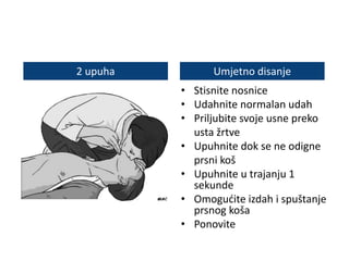 • Stisnite nosnice
• Udahnite normalan udah
• Priljubite svoje usne preko
usta žrtve
• Upuhnite dok se ne odigne
prsni koš
• Upuhnite u trajanju 1
sekunde
• Omogućite izdah i spuštanje
prsnog koša
• Ponovite
2 upuha Umjetno disanje
 