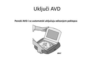 Uključi AVD
Poneki AVD-i se automatski uključuju odizanjem poklopca
 