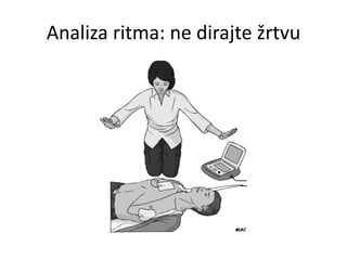 Analiza ritma: ne dirajte žrtvu
 