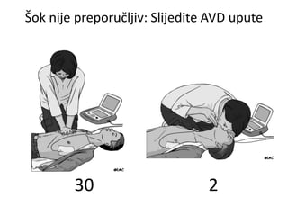 Šok nije preporučljiv: Slijedite AVD upute
30 2
 