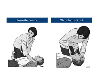 Pozovite pomoć Otvorite dišni put
 