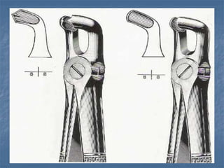 Claver Instrument Tooth Instrumentations of dental extraction and oral surgery | PPT