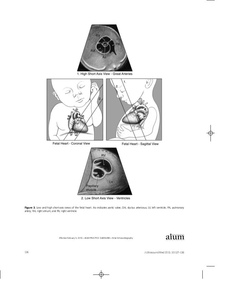 AIUM Practice Guideline for the Performance of Fetal Echocardiography