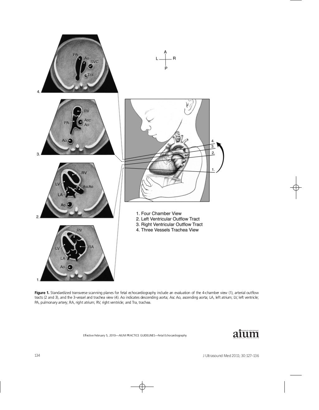 AIUM Practice Guideline for the Performance of Fetal Echocardiography