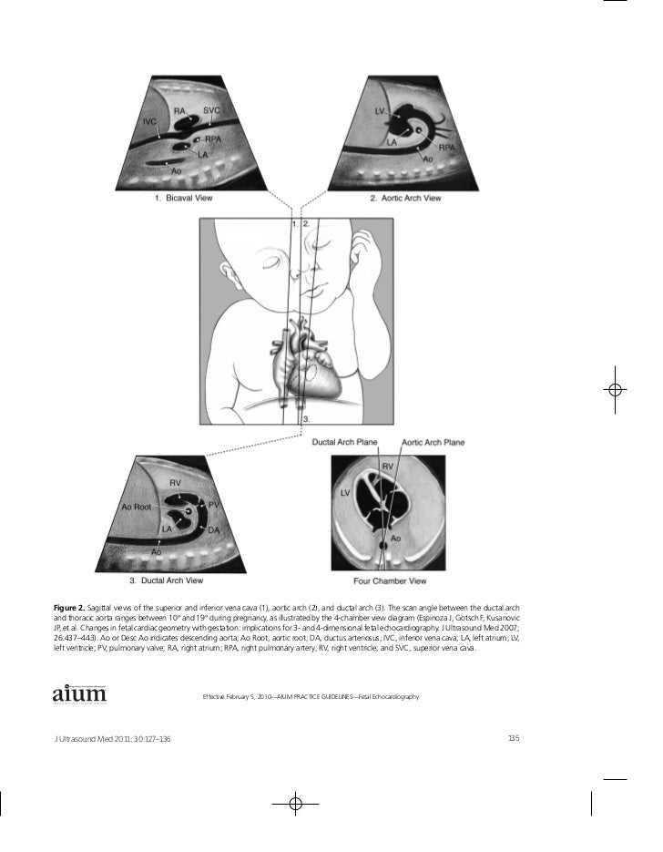 AIUM Practice Guideline for the Performance of Fetal Echocardiography