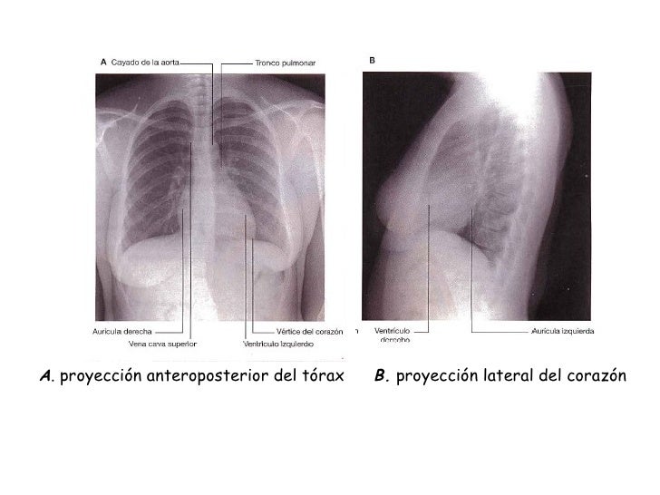 6°anatomia corazon