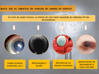 Deformações e
atrofia
Deficiências no
sistema imunitário
Quais são os impactos da redução da camada de ozônio?
Ao nível da saúde humana, os efeitos de uma maior exposição às radiações UV são
devastadores:
Lesões oculares
(cataratas, etc.)
Aparecimento de
queimaduras e
cancro da pele
 