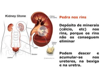 Doenças do sistema urinário