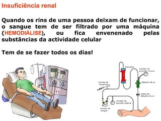 PRINCIPAIS DISTÚRBIO SIST URINÁRIO HUMANOGotaO ácido úrico da urina acumula-se nas articulações sob a forma de cristais, causando dor e inchaço.As pessoas com gota não devem comer:Mariscos, sardinha, salmão, bacon, fígado, etc.