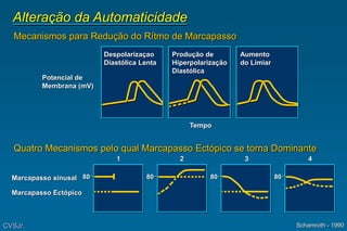 Alteração da Automaticidade
Despolarizaçao
Diastólica Lenta
Produção de
Hiperpolarização
Diastólica
Aumento
do Limiar
Potencial de
Membrana (mV)
80 80 80 80
Schamroth - 1990
Marcapasso sinusal
Marcapasso Ectópico
Tempo
1 2 3 4
Mecanismos para Redução do Rítmo de Marcapasso
Quatro Mecanismos pelo qual Marcapasso Ectópico se torna Dominante
CVSJr.
 