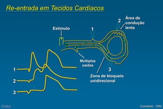 Re-entrada em Tecidos Cardíacos
Estímulo
Área de
condução
lenta
Zona de bloqueio
unidirecional
1
2
3
Cranefield - 1992
1
2
3
CVSJr.
Múltiplas
saídas
 