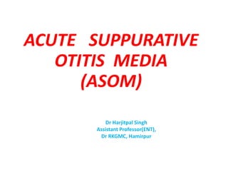 ACUTE SUPPURATIVE OTITIS MEDIA | PPTX