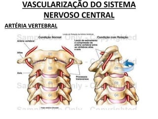 VASCULARIZAÇÃO DO SISTEMA
NERVOSO CENTRAL
ARTÉRIA VERTEBRAL
 