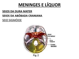 MENINGES E LÍQUOR
SEIOS DA DURA MATER
SEIOS DA ABÓBADA CRANIANA
SEIO SIGMÓIDE
 