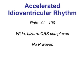 Accelerated Idioventricular Rhythm Rate: 41 - 100 Wide, bizarre QRS complexes No P waves 