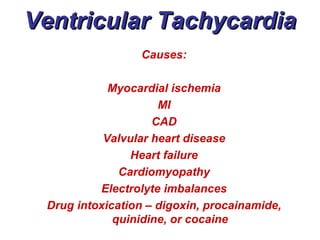 Ventricular Tachycardia Causes: Myocardial ischemia MI CAD Valvular heart disease Heart failure Cardiomyopathy Electrolyte imbalances Drug intoxication – digoxin, procainamide, quinidine, or cocaine 