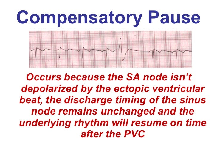 Ventricular Rhythms BMH/Tele