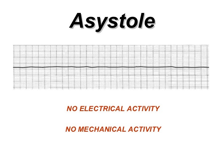 ventricular rhythms bmh tele h r block resume