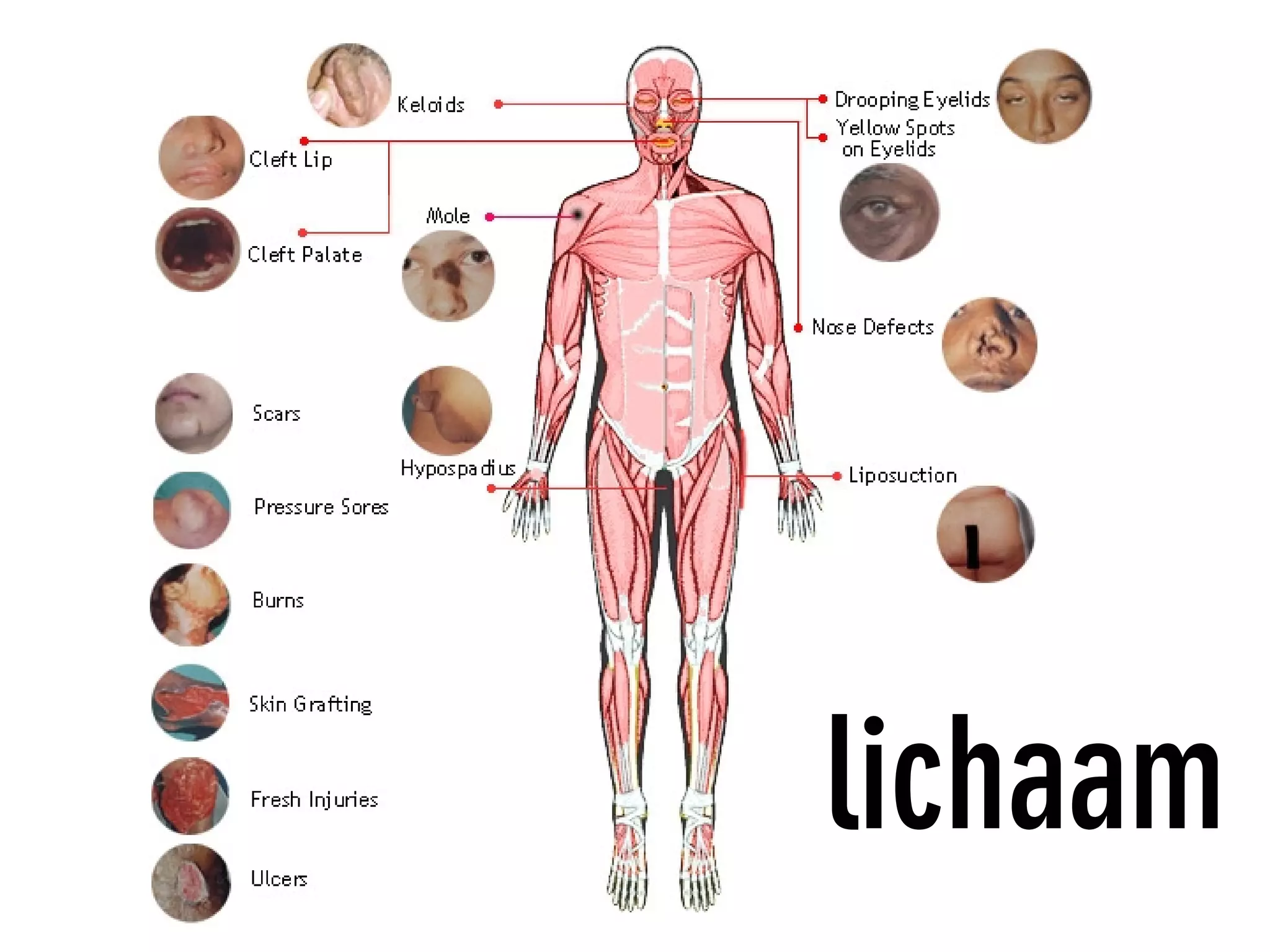 lichaam
 
