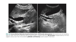Comprehensive Imaging and RADIOLOGY of the Biliary Tract | PPTX