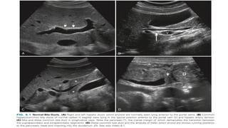 Comprehensive Imaging and RADIOLOGY of the Biliary Tract | PPTX
