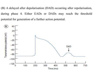 (B) A delayed after depolarisation (DAD) occurring after repolarisation,
during phase 4. Either EADs or DADs may reach the threshold
potential for generation of a further action potential.
 