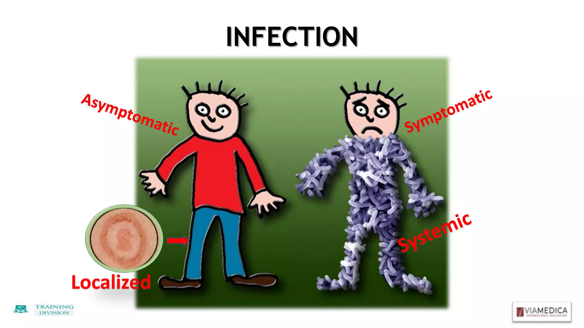 Localized
INFECTION
 