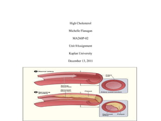High Cholesterol
Michelle Flanagan
MA260P-02
Unit 8Assignment
Kaplan University
December 13, 2011
 