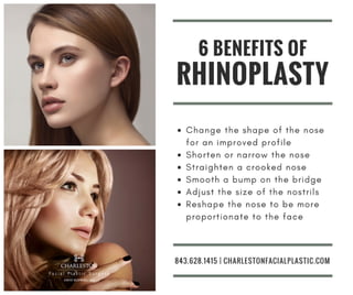 6 benefits of rhinoplasty