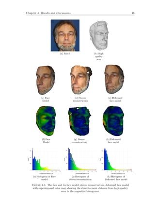 Chapter 4. Results and Discussions 46
(a) Face I (b) High
quality
scan
(c) Face
Model
(d) Stereo
reconstruction
(e) Deformed
face model
(f) Face
Model
(g) Stereo
reconstruction
(h) Deformed
face model
(i) Histogram of Face
model
(j) Histogram of
Stereo reconstruction
(k) Histogram of
Deformed face model
Figure 4.3: The face and its face model, stereo reconstruction, deformed face model
with superimposed color map showing the cloud to mesh distance from high-quality
scan in the respective histograms.
 