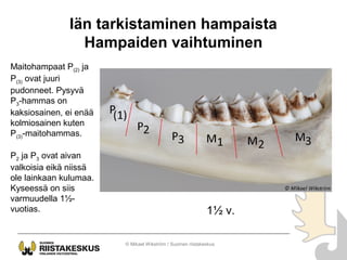 Iän tarkistaminen hampaista
Hampaiden vaihtuminen
Maitohampaat P(2) ja
P(3) ovat juuri
pudonneet. Pysyvä
P3-hammas on
kaks...