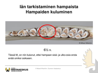 Iän tarkistaminen hampaista
Hampaiden kuluminen
© Mikael Wikström / Suomen riistakeskus
6½ v.
Tässä M1 on niin kulunut, et...